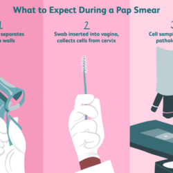 Can you get a pap test while on your period