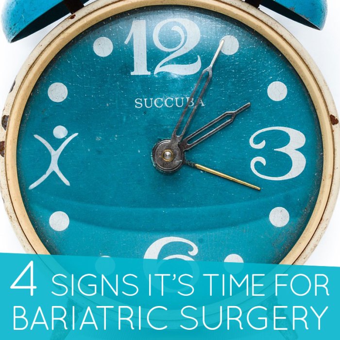 How to get time off work for bariatric surgery