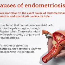 Endometriosis symptoms if know