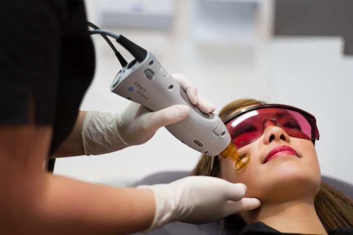 Can you use laser hair removal on your head