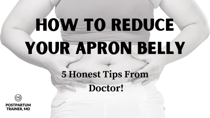 Can you get rid of apron belly without surgery