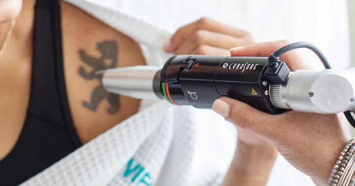 Can you do laser hair removal over a tattoo