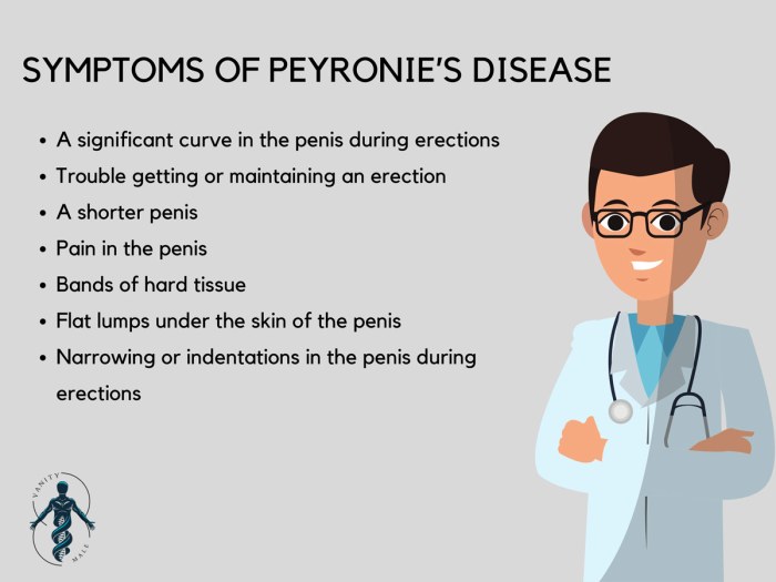 Peyronie disease treatment